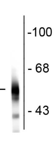 Western Blot - Mouse Anti-Tubulin B III antibody