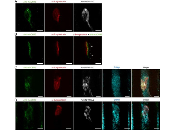 Immunofluorescence using NFM