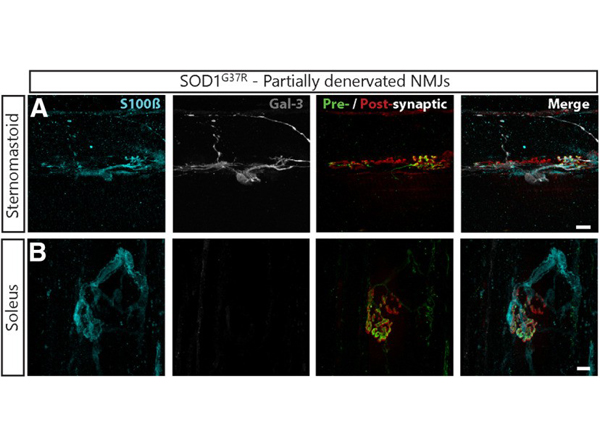 Immunofluorescence using NFM