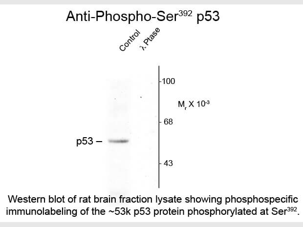 Western blot of Anti-p53 pS392 (Rabbit) Antibody - 600-401-E04
