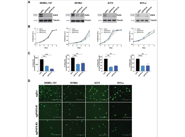 Western Blot using 451Lu