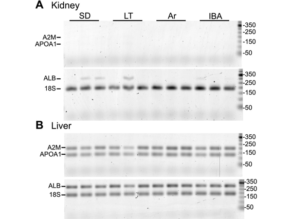 Western Blot using APOA1