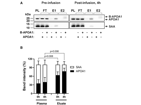 Western Blot using APOA1