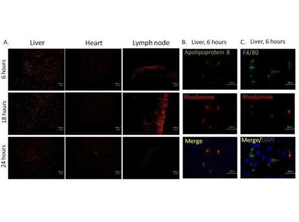 Immunofluorescence using APOB