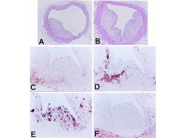 Immunohistochemistry using APOB