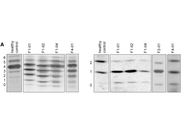 Western Blot using APOC III