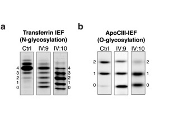 Western Blot using APOC III