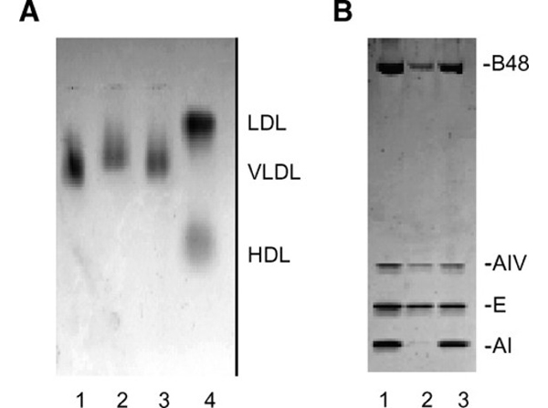 SDS using APOA1