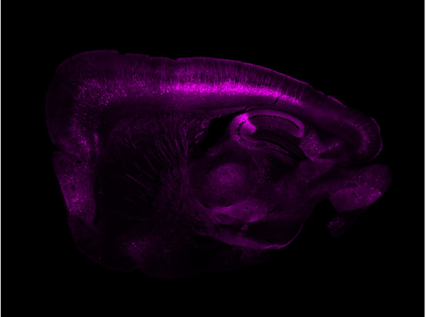 Immunofluorescence results using Goat Anti-GFP Antibody.