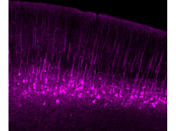 Immunofluorescence results using Goat Anti-GFP Antibody.