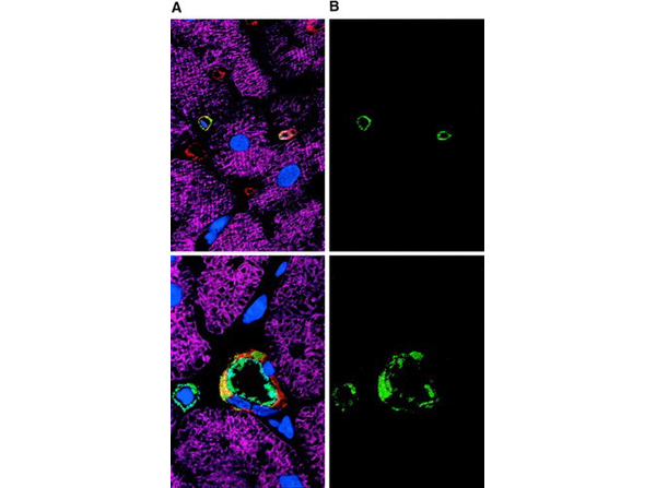 Immunofluorescence using GFP