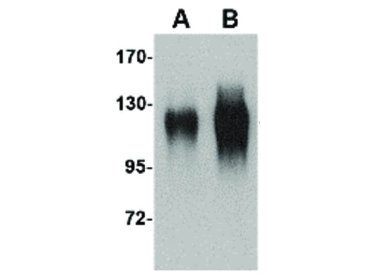 Western Blot of gp120 Antibody