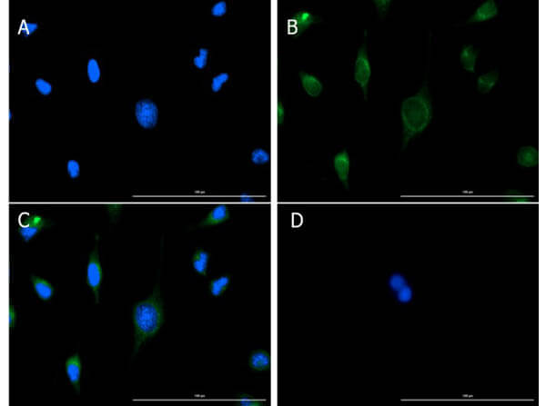 Immunofluorescence of Goat Anti-VDAC/Porin Antibody