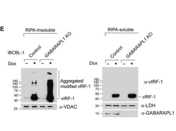 Western Blot using VDAC
