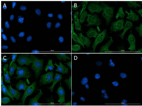Immunofluorescence Microscopy of anti-Aldh1l1
