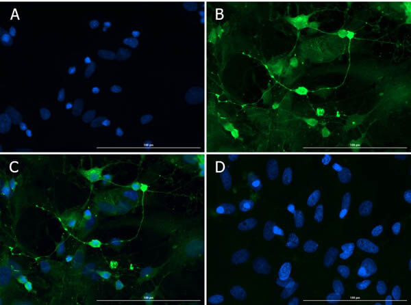 Immunofluorescence microscopy of Anti-Doublecortin in PND1 cells