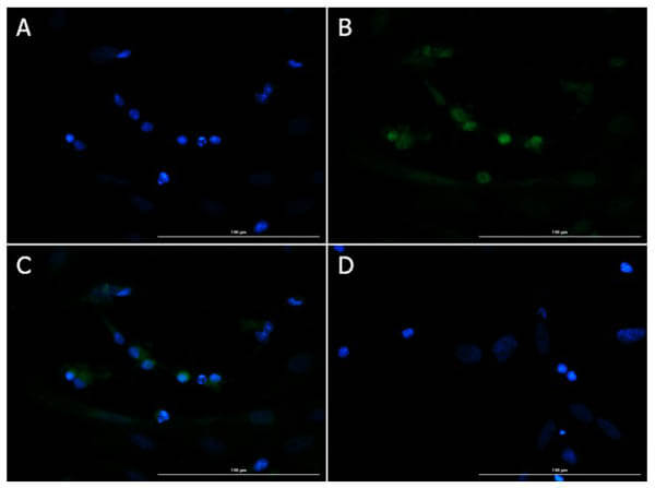 Immunofluorescence of Goat Anti-Brn3b Antibody