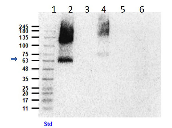 Western Blot of anti-Eaat2 Antibody