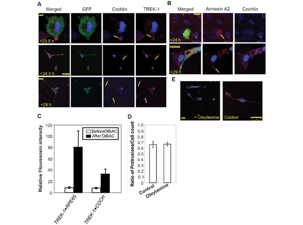 Immunofluorescence using GFP