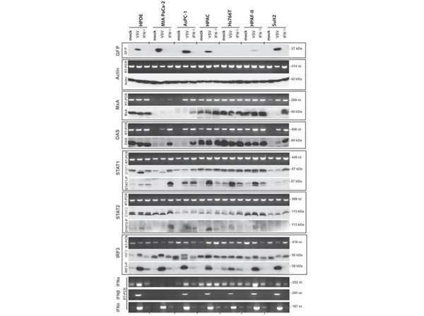 Western Blot using GFP