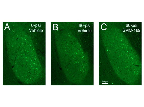 Immunofluorescence using GFP
