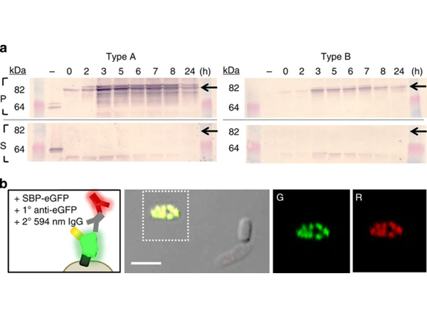 Immunofluorescence using GFP