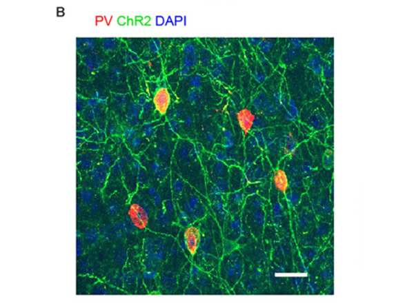 Immunofluorescence using GFP