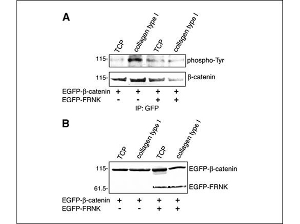 Western Blot using GFP