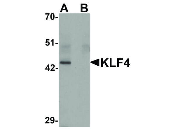 Western Blot of KLF4 Antibody