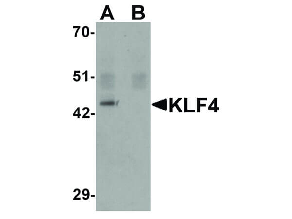Western Blot of KLF4 Antibody