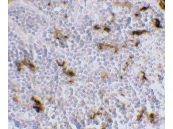 Immunohistochemistry of DC-SIGN