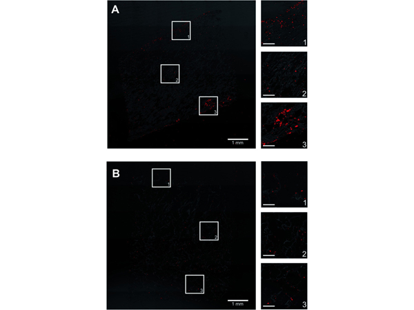 Immunofluorescence using HSA