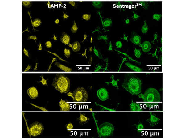 Immunofluorescence using Biotin