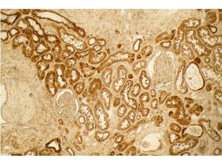 Collagen Type I Antibody