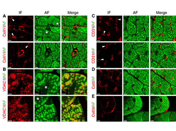 Immunofluorescence using Collagen Type I