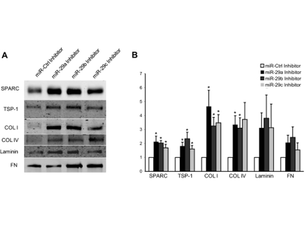 Western Blot using Collagen Type I
