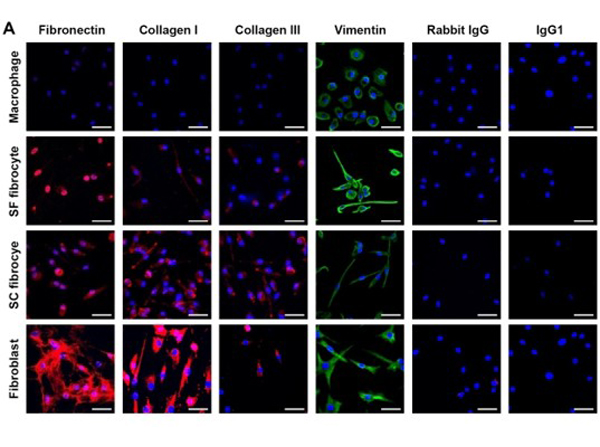 Immunofluorescence using Collagen Type I