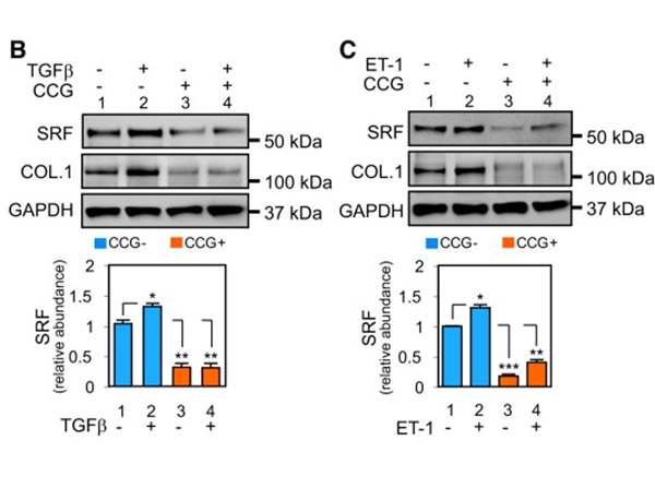 Western Blot using Collagen Type I