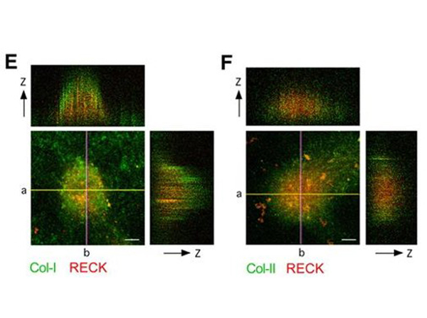 Immunofluorescence using Collagen Type II