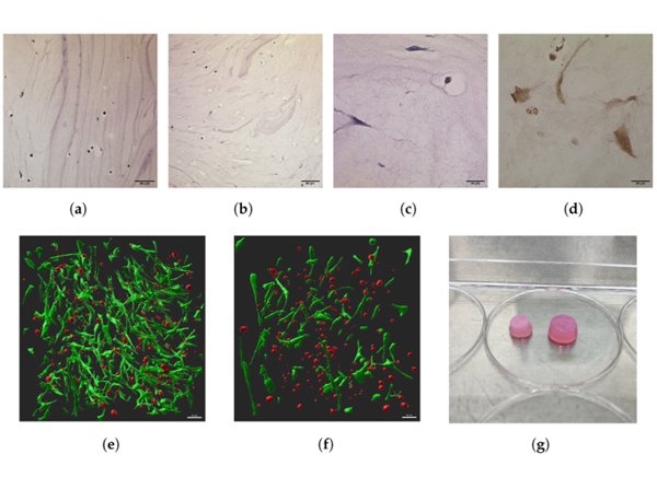 Immunohistochemistry using Collagen Type II