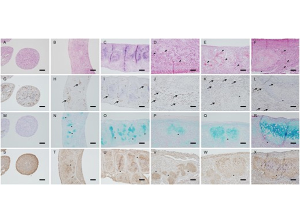 Immunohistochemistry using Collagen Type II