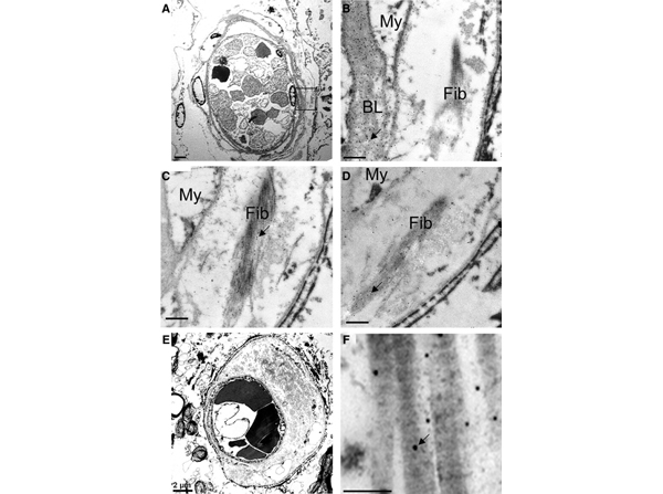 IEM using Collagen Type III