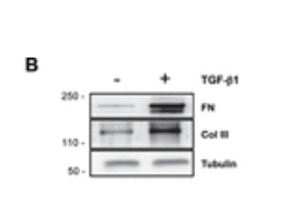 Western Blot using Collagen Type III