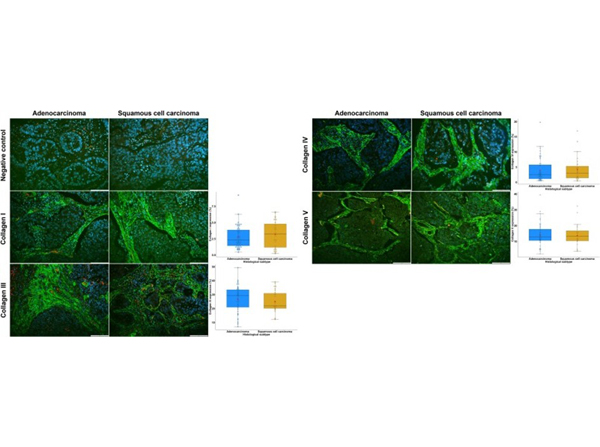 Immunofluorescence using Collagen Type III