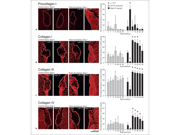 Immunohistochemistry using Collagen Type III