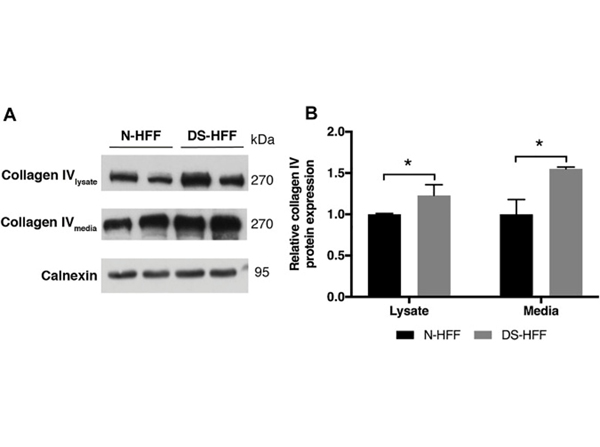 Western Blot using Collagen Type IV