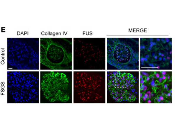 Immunofluorescence using Collagen Type IV