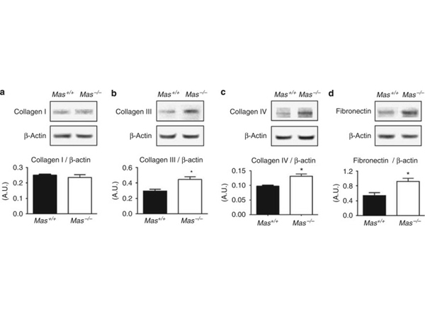 Western Blot suing Fibronectin