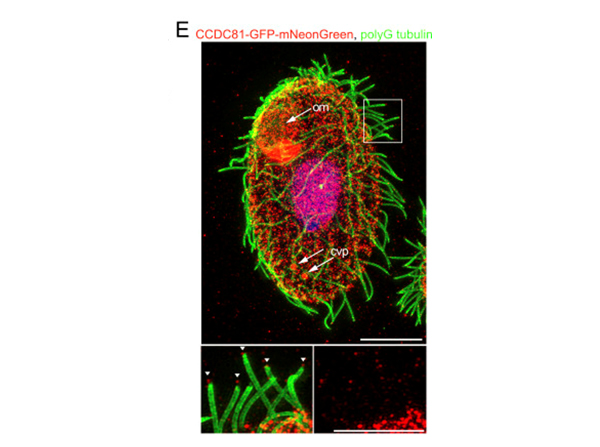 Immunofluorescence using GFP