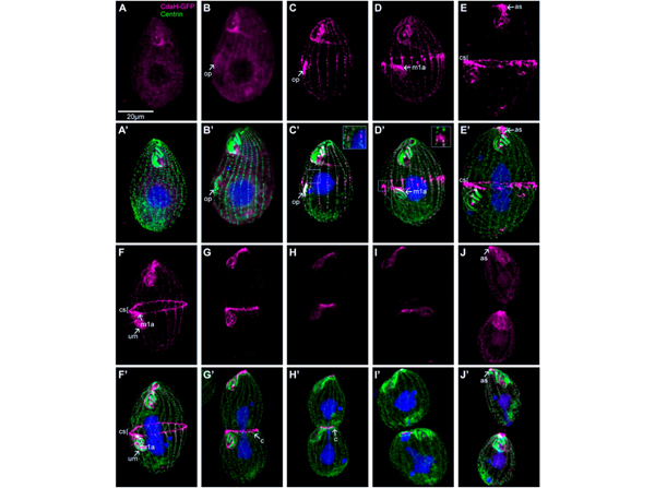 Immunofluorescence using GFP